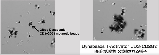 T細胞活性化・増殖のワークフローと「Dynabeads T-Activator」の